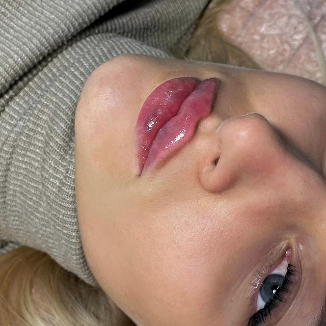 ...
